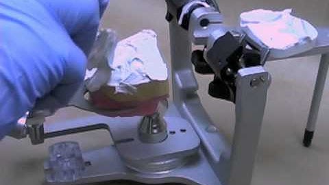 26 Mount Maxillary Cast