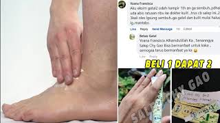 Salep Chy Gao Ampuh Atasi Gatal Menahun Kudis  Kurap Serta Masalah Kulit Lainnya