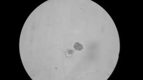 Phytophthora pini zoospore release