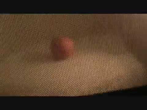 Microwaved Egg Explodes