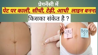 Nabhi Line Se Kaise Pta Kare Ladka Hai Ya Ladki ॥Baby Boy Prediction In Pregnancy ॥ Gender Predict