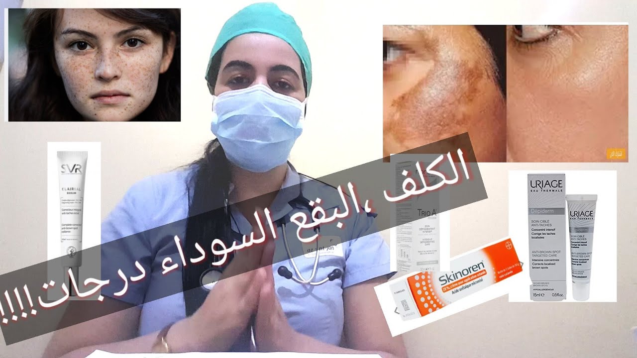 الكلف #علاج_الكلف # جميع الحلول لدرجات الكلف، تصبغات البشره و النمش