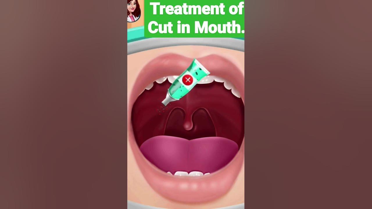 treatment-of-cut-inside-mouth-animation-video-doctor-surgery-video