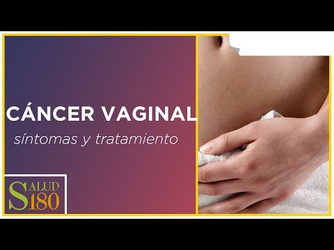 Vídeo: Cáncer De Vagina: Síntomas, Causas, Tratamiento Y Más