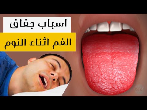 اسباب جفاف الفم اثناء النوم
