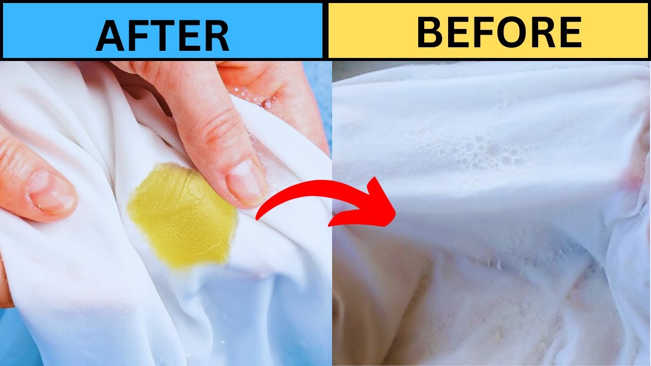 how To Remove Vaseline Stains From Fabric And White Clothes With ...