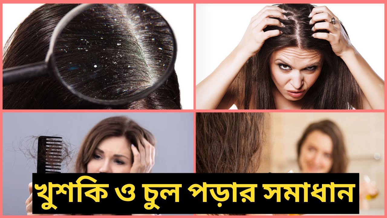 Mim Tips খুশকি ও চুল পড়ার সমাধান ll Mim Afrin Beauty Tips - YouTube