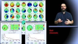 Ica Applied To Eeg Part 8 Removing Artifactual Components In Eeglab