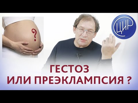 Гестоз и преэклампсия. Чем отличается гестоз от преэклампсии? Отвечает доктор Гузов И.И.