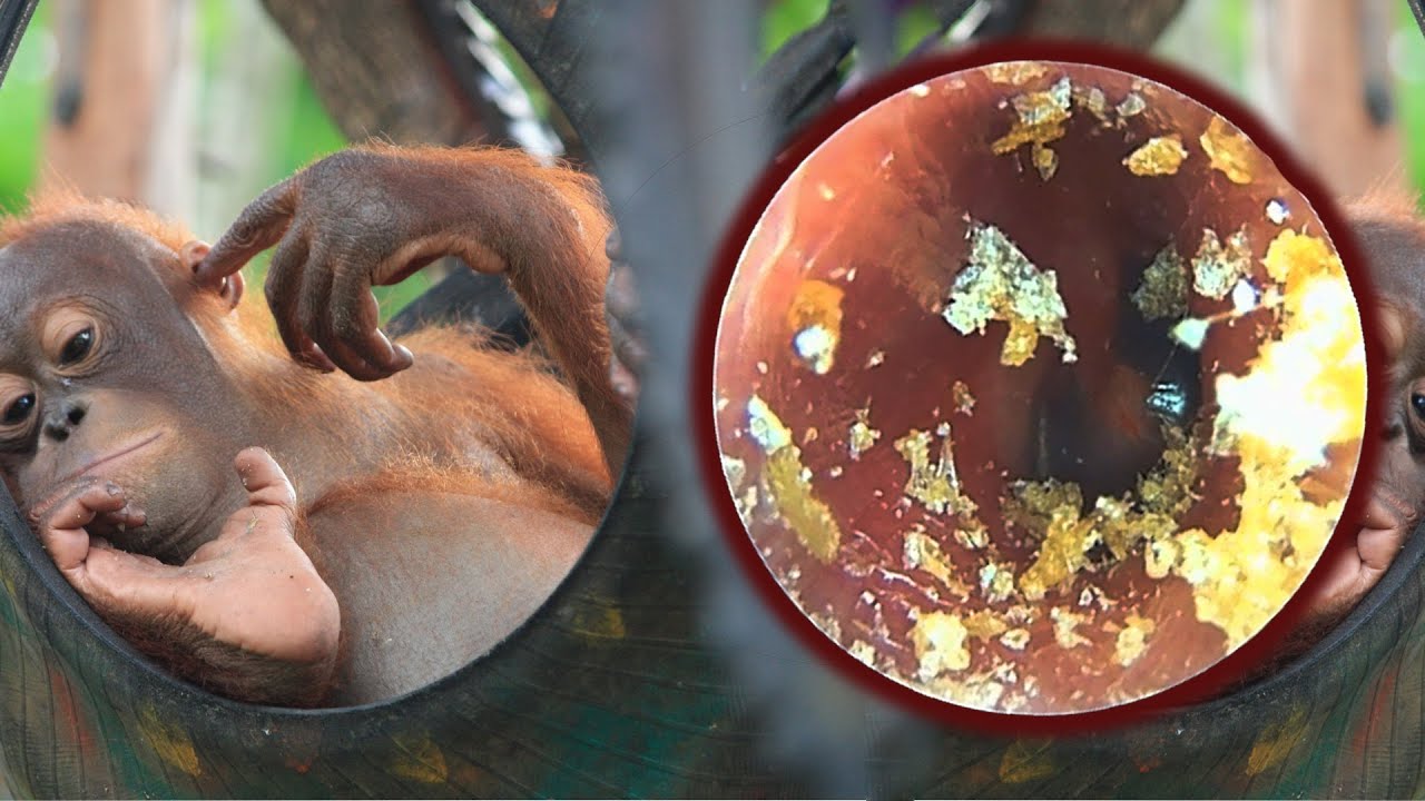 耳垢除去デブロックス、ear wax removal debrox part 416 YouTube