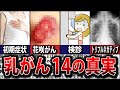 乳がんの質問にすべて答えます【初期症状/完治/早期発見/費用/末期/検診/しこり/花咲乳がん/治療/余命/完治/トリプルネガティブ】