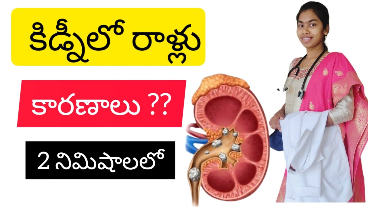 kidney-stones-causes-in-telugu-youtube