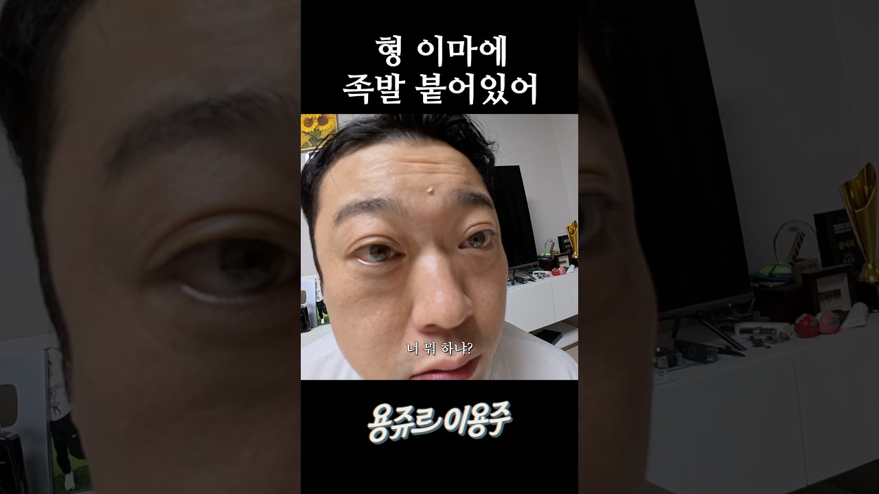 형 이마에 족발 붙어있어