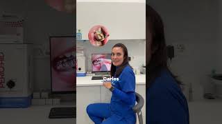Férula de descarga de farmacia para dormir: ¿sirve para el bruxismo? | Cleardent