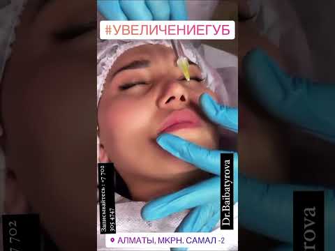 Аугментация губ - YouTube