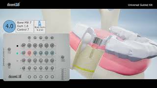 Universal Guided Kit – User Guide Video
