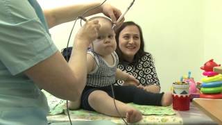 видео Асфиксия при родах: последствия у новорожденного ребенка