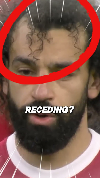 SALAH WENT BALD!