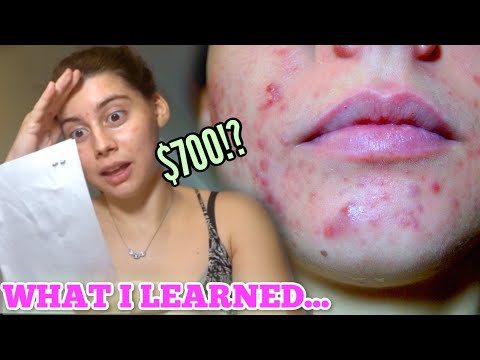 I SPENT OVER $700 ON A NATUROPATH FOR MY ACNE || Here is what happened.. my experience.