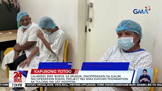 Lalaking may bukol sa mukha, naoperahan sa ilalim ng Operation Bukol Project ng GMA... | 24 Oras