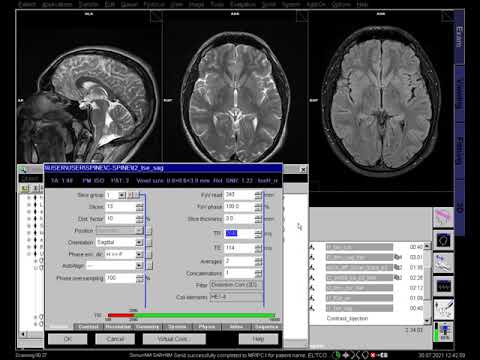 МРТ ШОП( протокол) #mri#mrt#работа