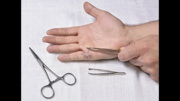 Cpt code for Removal of foreign body in muscle - simplify medical coding