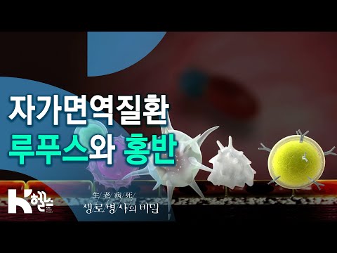 자가면역질환 "루푸스"와 "홍반" - 726회(20.02.12) SOS! 피부가 보내는 구조신호