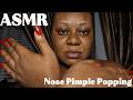 ASMR | NOSE PIMPLE POPPING ON MY FACE | #pimplepopping #asmr #nitpicking #pimple #viral #asmrsounds