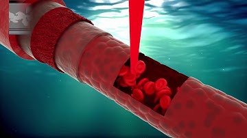 SS OCT Angio  - OCT Angiography for Topcon Swept Source OCT