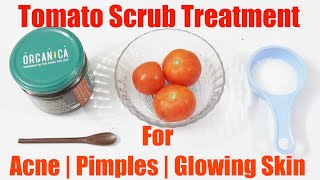 Tomato Scrub Treatment for Acne | Pimple and Glowing Skin #FoodLovers