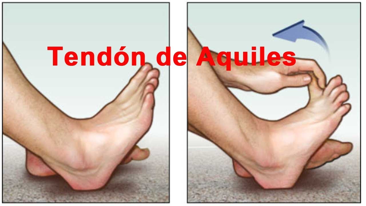 Que hacer cuando se te monta un tendon del pie