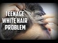 White Hair Problem | Natural Dye | TheRealMenShow★