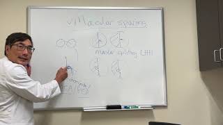 Macular Sparing In Stroke