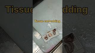 Tissue embedding cassette 😟🤔| #histopathology #tissue #sectioncutting #histopathologylab #pathology screenshot 2