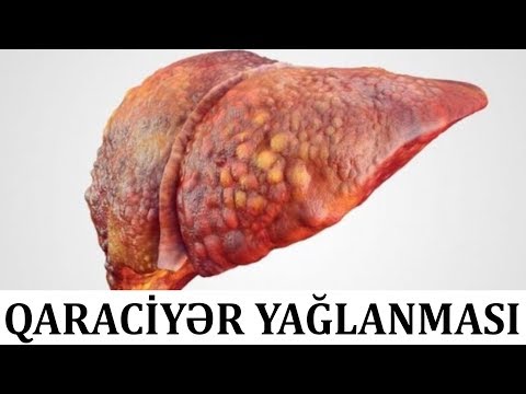 Video: Qaraciyərdə nə metabolizə olunur?