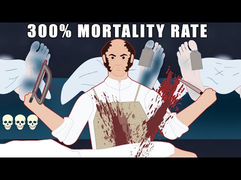 How Did this Surgeon Kill 3 People in 1 Operation?