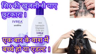सिर की जुओं का पक्का इलाज? | Ivermectin Shampoo 0.5% IVREA Full Review | Uses, Dose &amp; Side Effects।