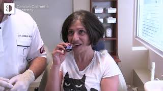 Dentures vs Food 😁🍎 Implant dentures test with apple, snickers! 🍫 Eat Anything with Dental Implants