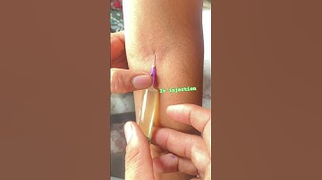 Intravenous injection use ll iv injection kese lagaye ll #ivinjection #shorts