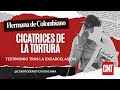 “Tiene fractura de cordales y cicatrices de electricidad”, hermana de colombiano excarcelado 