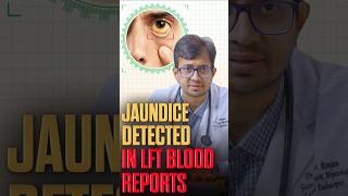 Jaundice Report in LFT | Bilirubin Explained | Dr. Abhijeet Ranjan, Gurugram #liverfunctiontest