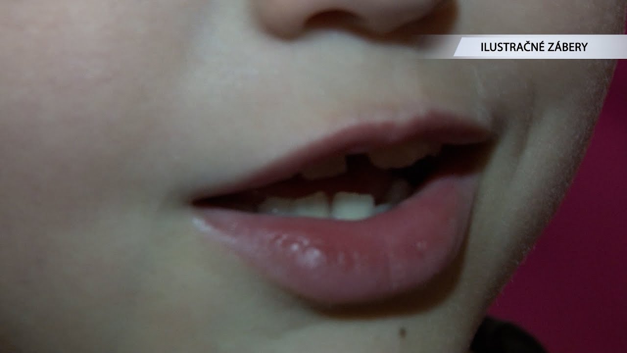 Jazykové predpoklady detí