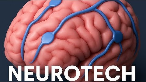 Neurotech: Brain-Computer Interfaces You Need to Know About