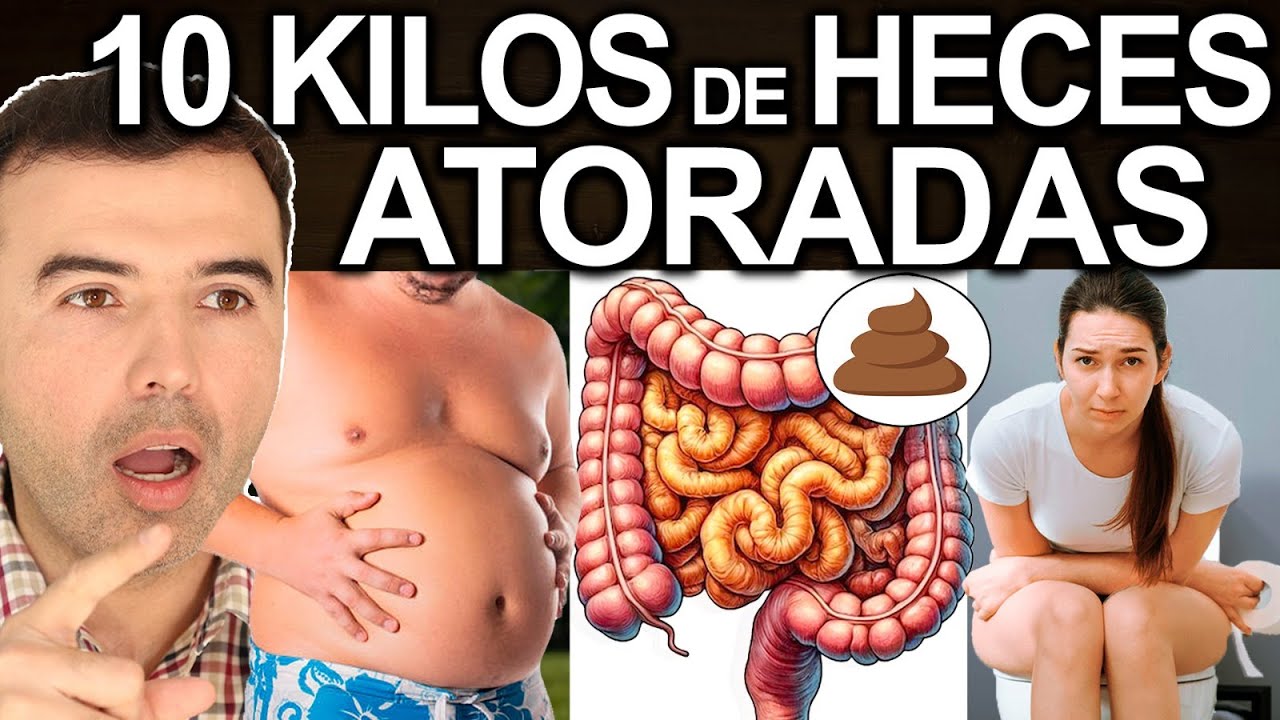 10 Kilos De Heces Atoradas En Tu Colon - Signos Y Síntomas De Mucha ...