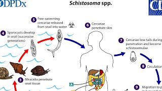 Schistosomiasis Dr. Fady Magdy//أوضح شرح باراسيتولوجي بالعربي( البلهارسيا) د. فادي مجدي