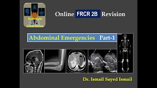 Abdominal Emergencies for FRCR 2B - Part 1