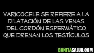 VARICOCELE