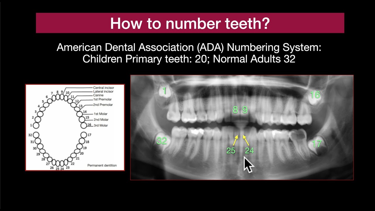 Dental Panorex Part 3 Clinical Cases. YouTube