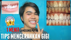 CARA MEMUTIHKAN GIGI KUNING DENGAN CEPAT || DALAM 1 MENIT || RAHUL EFENDY - Durasi: 5.01. 