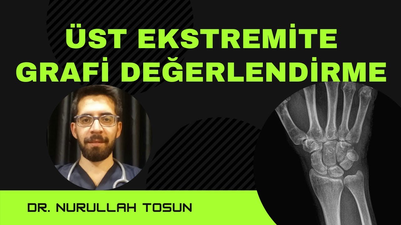 Üst Ektremite Grafi Nurullah Tosu